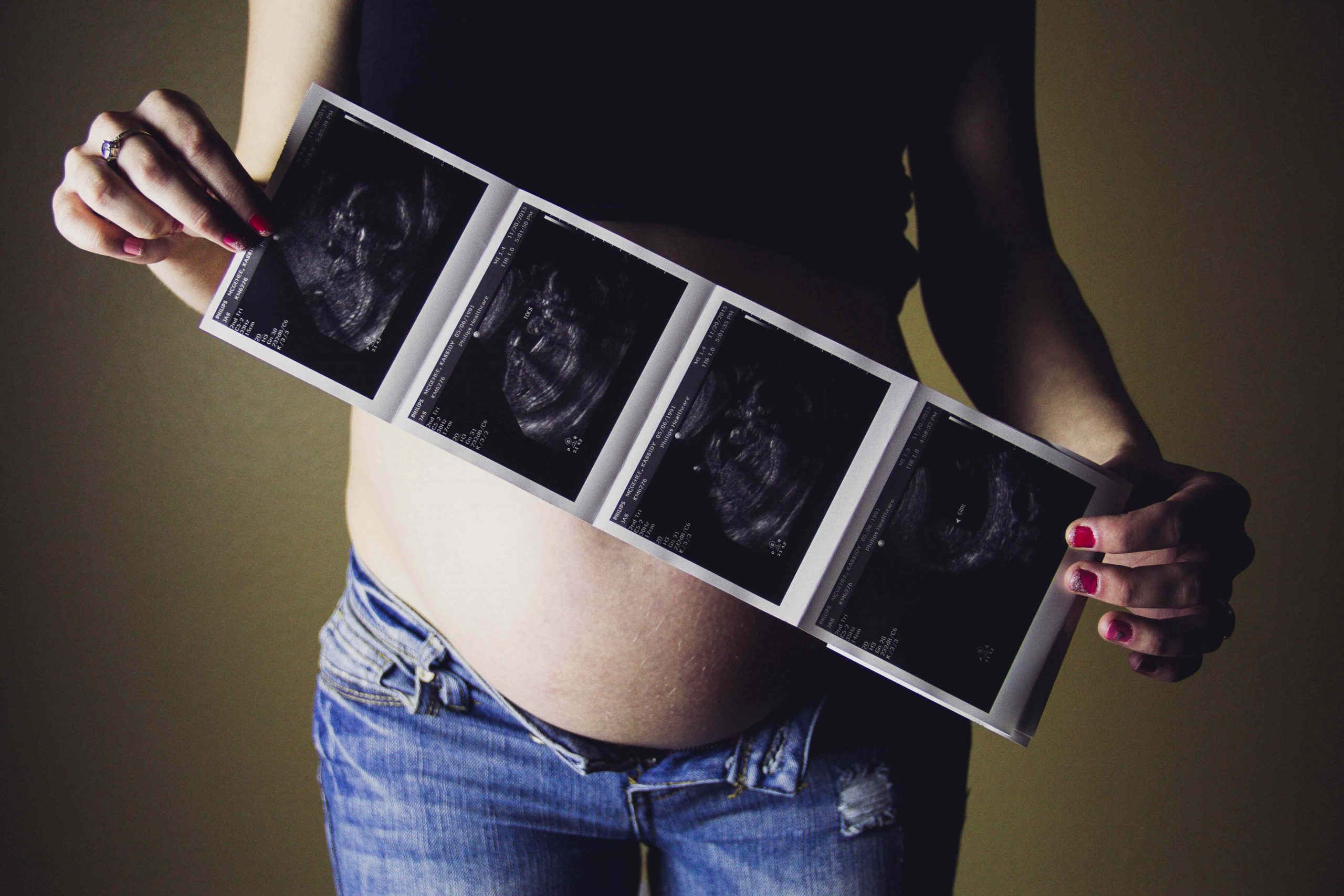 morfologie fetala ploiesti