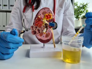 infectia urinara la rinichi