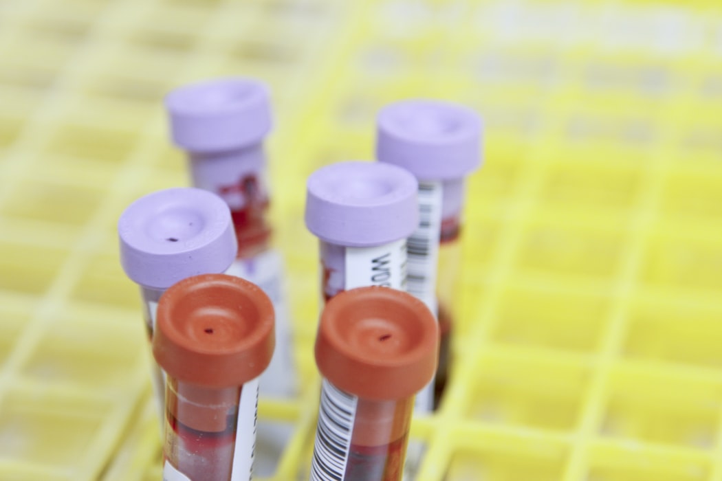 beta HCG