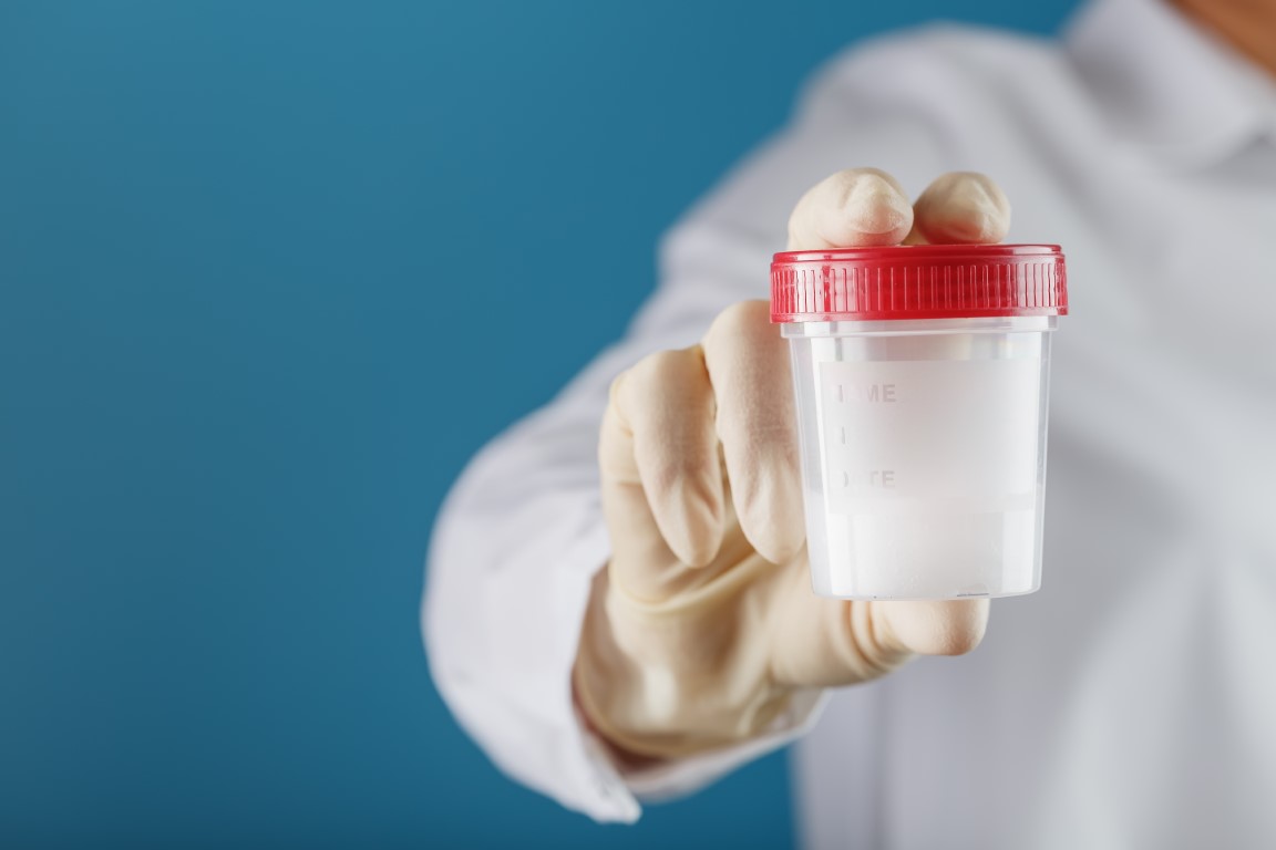 Ejaculare retograda dupa operatiea de prostata