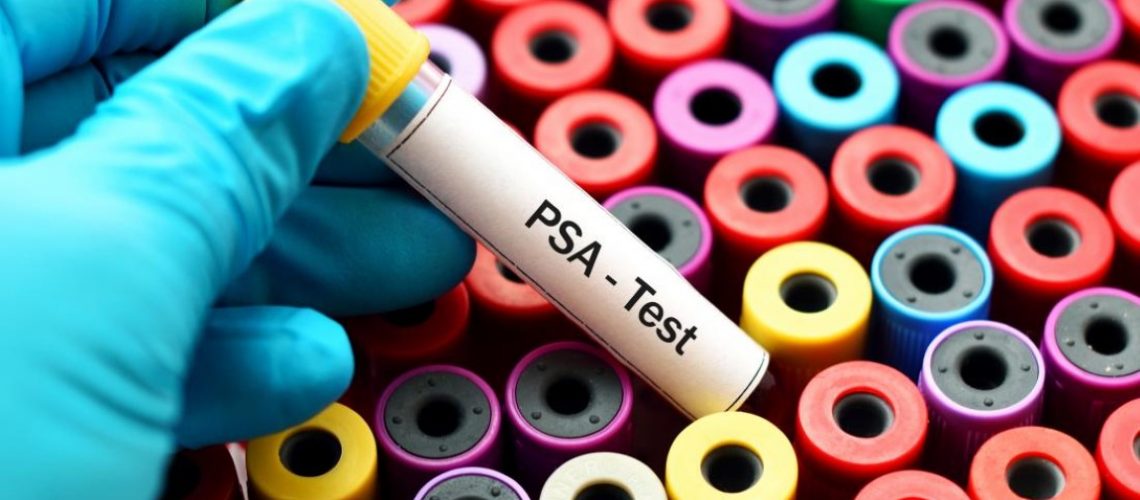 Antigen specific prostatic PSA-medicalnewstoday.com (Medium)